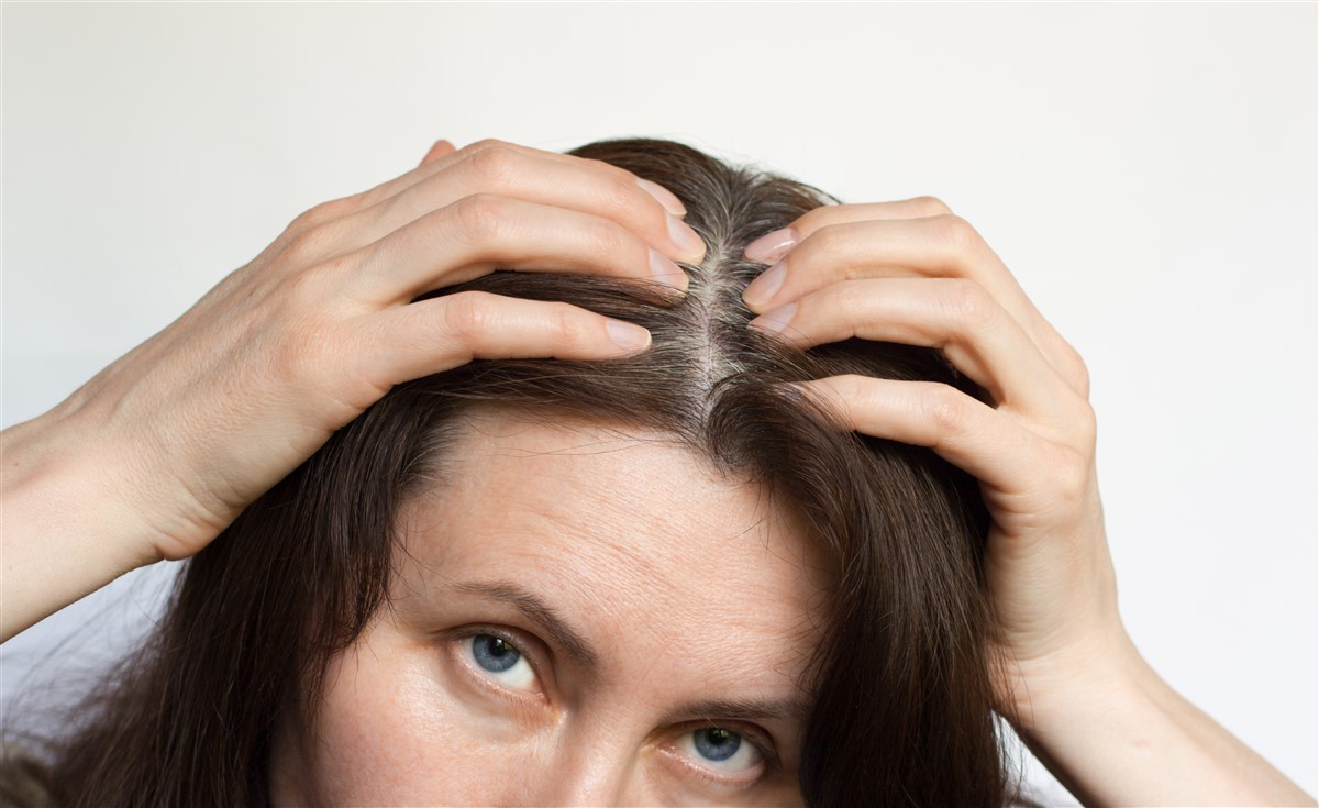 épilation des cheveux blancs à la racine